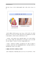 중환아실 간호사 아동의 정서적 요구를 충족시키는데 도움이 되는 간호중재, 소아 위관영양법 목적과 간호, 울혈성 심부전 환아 간호중재 및 치료계획-9