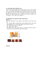 [간호학] 치질(hemorrhoid) 치료(자가간호)-2