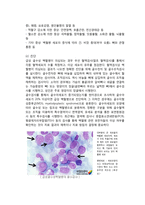 백혈병의 분류 레포트-3