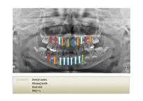 교정학-소아치과 case based learning-6