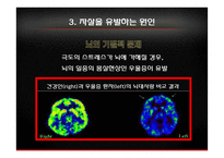 우리나라 자살률과 예방법-11