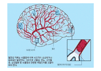 가족정책론 치매 완성-16