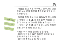 한의학 시술법 및 세계화 방안 고찰-9