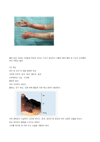 의료사회복지 화상환자 접근-5