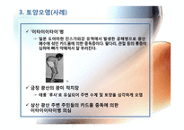 광산지역의 토양 및 수질오염-14