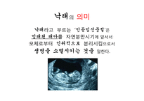 낙태 반대입장 레포트-4