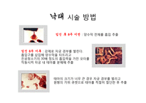 낙태 반대입장 레포트-8