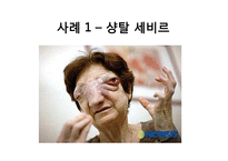 안락사에 대한 찬반 논란-18