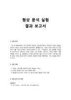 [기계설계] 형상분석 실험 결과 보고서-1