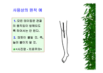 [물리치료] 밸런스 테이핑 요법에 관해-14