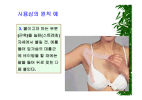 [물리치료] 밸런스 테이핑 요법에 관해-15