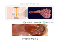 [조직학] 검체의 절취와 처리법, 조직 검체의 종류-16