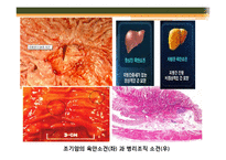 [조직학] 검체의 절취와 처리법, 조직 검체의 종류-17