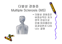 질환별 물리치료 - 파킨슨, 다발성경화증에 물리치료-13