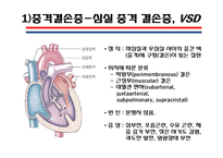 [의학] 선천성 심장질환[Congenital heart disease]에 관해-9