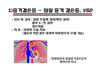 [의학] 선천성 심장질환[Congenital heart disease]에 관해-10