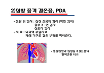 [의학] 선천성 심장질환[Congenital heart disease]에 관해-12