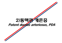 [의학] 선천성 심장질환[Congenital heart disease]에 관해-13