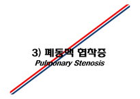 [의학] 선천성 심장질환[Congenital heart disease]에 관해-15