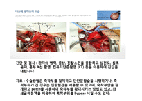 [의학] 선천성 심장질환[Congenital heart disease]에 관해-20
