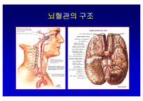 [뇌손상] 뇌졸중[중풍]이란 - 재활의학적 관점-9