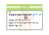 해부생리학 - 심근경색[Myocardial Infarction]에 대해-3