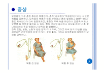 [병리학] 담석증에 관해-6
