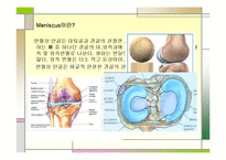 [의학] 반월상 연골판 손상-3