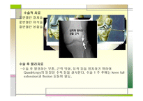 [의학] 반월상 연골판 손상-11