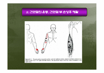 [운동치료학] 견관절 손상의 재활-11
