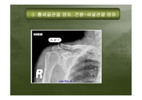 [운동치료학] 견관절 손상의 재활-17