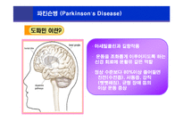 [뇌손상] 파킨슨병[Parkinson’s Disease]에 관해-3