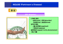 [뇌손상] 파킨슨병[Parkinson’s Disease]에 관해-8