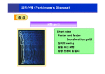 [뇌손상] 파킨슨병[Parkinson’s Disease]에 관해-12