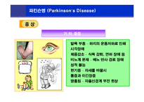[뇌손상] 파킨슨병[Parkinson’s Disease]에 관해-16