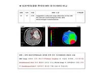 [해부생리] 기저핵[Basal Ganglia]에 대해-19