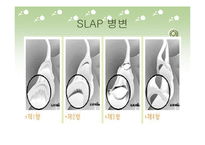 [물리치료] 동결견 및 slap 병변-12