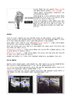 [의학] 오십견. 동결견[frozen shoulder]-2