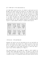 [질환별 물리치료] 하지절단에 관해서-2