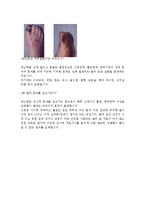 [질환별 물리치료] 하지절단에 관해서-9