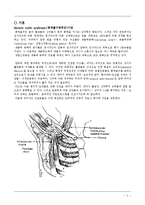 물리치료 - thoracic outlet syndroe[흉곽출구증후군]에 대해서-2