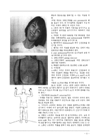 물리치료 - thoracic outlet syndroe[흉곽출구증후군]에 대해서-9