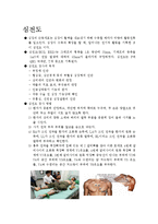 [의학] 심전도[ECG, EKG]에 관해서-1