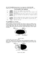척수손상[Spinal Cord Injury; SCI]에 관해-5