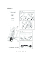 척수손상[Spinal Cord Injury; SCI]에 관해-10