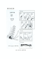 척수손상[Spinal Cord Injury; SCI]에 관해-11