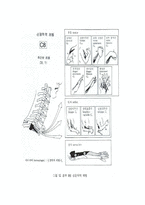 척수손상[Spinal Cord Injury; SCI]에 관해-12