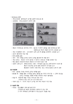 [의학] 추간판탈출증[Herniated Intervertebral Disc, HID]에 관해-3
