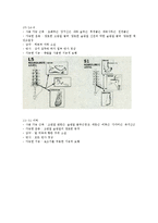 척수손상 - Spinal Cord Injury [SCI]-8