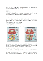 신경계 질환별 물리치료 - 복합성 부위 통증증후군[CRPS; Complex Regional Pain Syndrome]-3